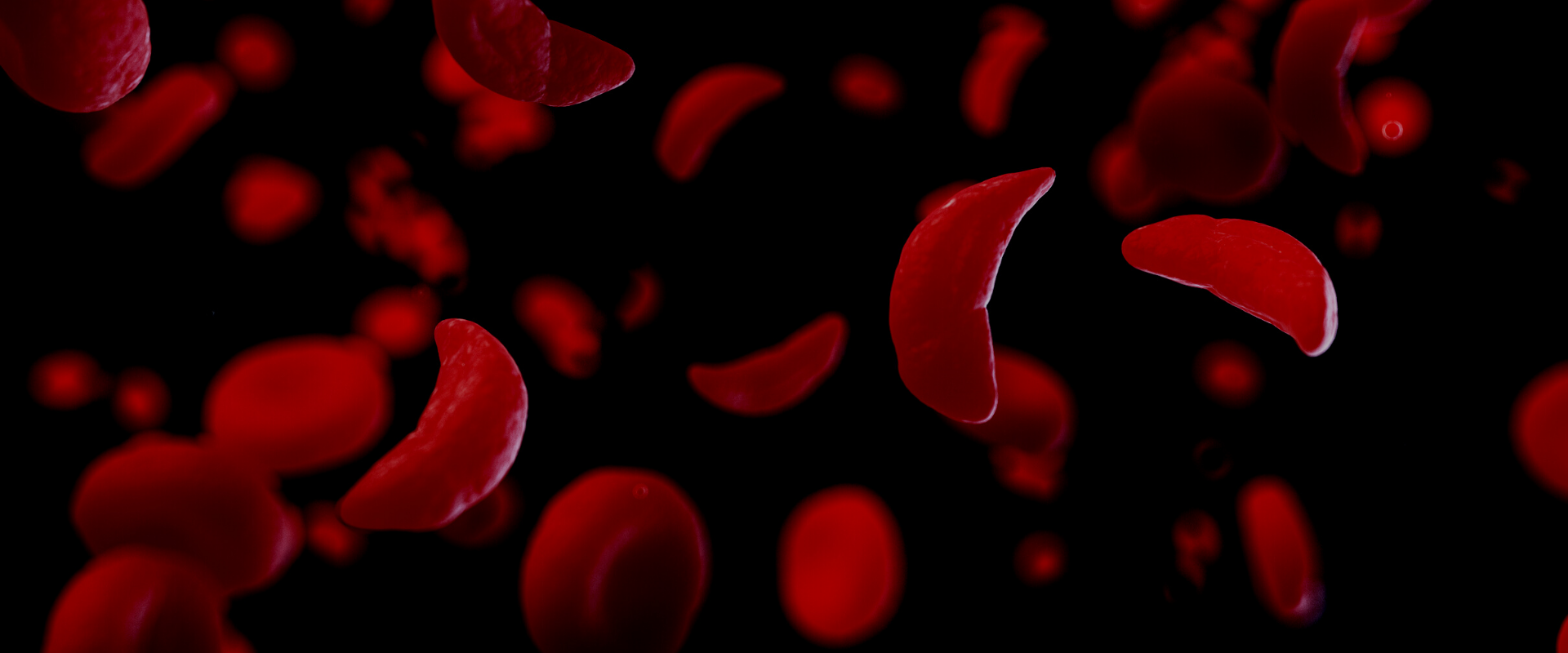 MARAC Issues an Update on COVID-19 and Sickle Cell